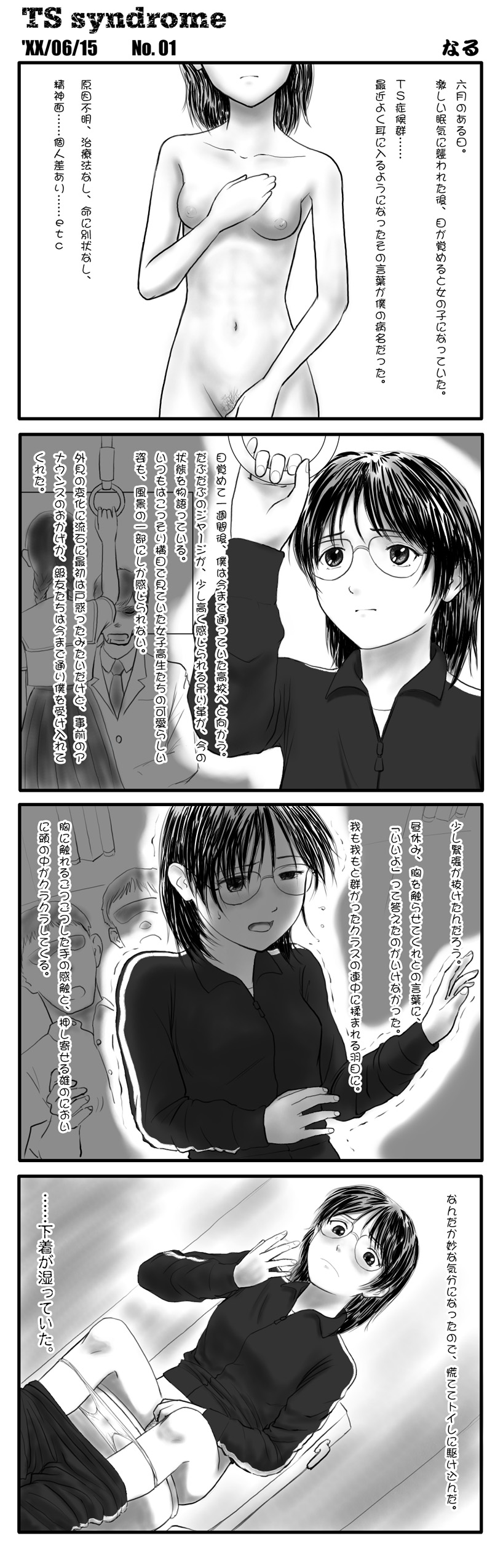TS syndrome page 1 full